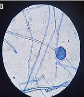 Jundishapur J Microbiol